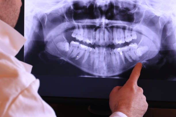 Best Weekend Emergency Dentist in Auburn, WA